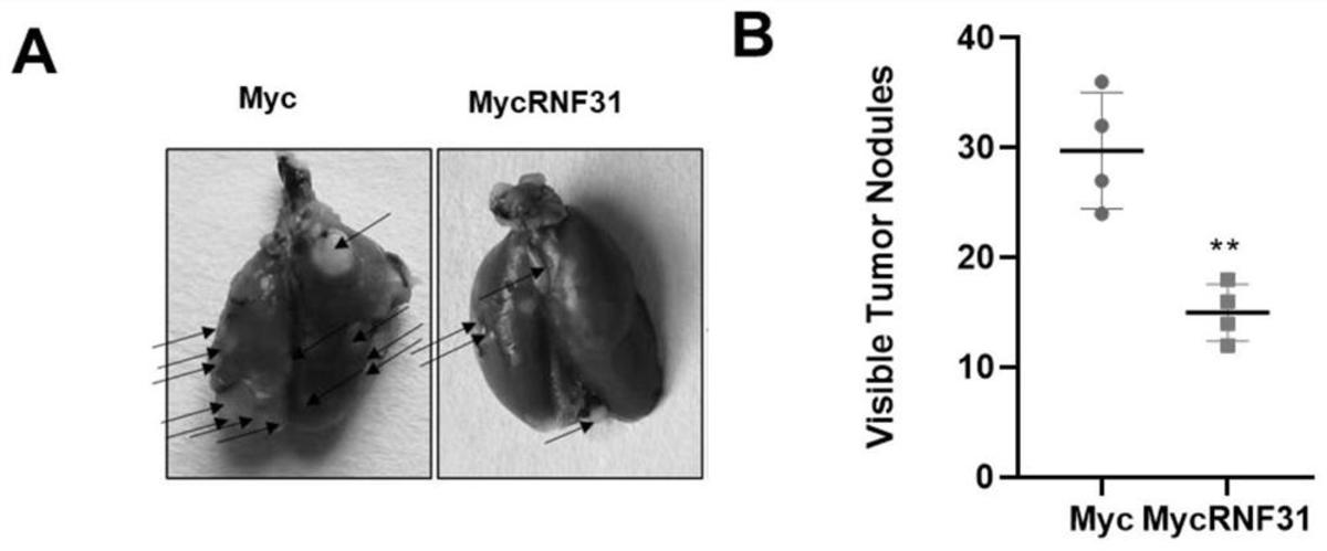 RNF31基因表達促進劑在制備治療TNBC的藥物中的應用