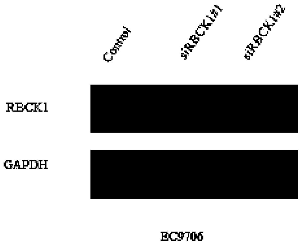 一種用于檢測食管癌細(xì)胞遷移和侵襲能力的分子標(biāo)志物及其應(yīng)用