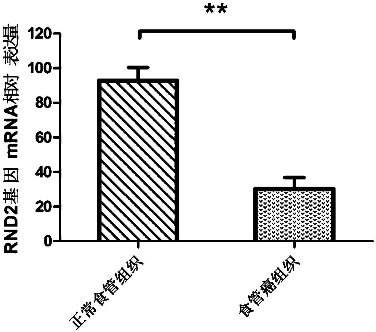 一種食管癌檢測、診斷或者預(yù)后評價(jià)制劑，治療食管癌的藥物及RND2基因的應(yīng)用