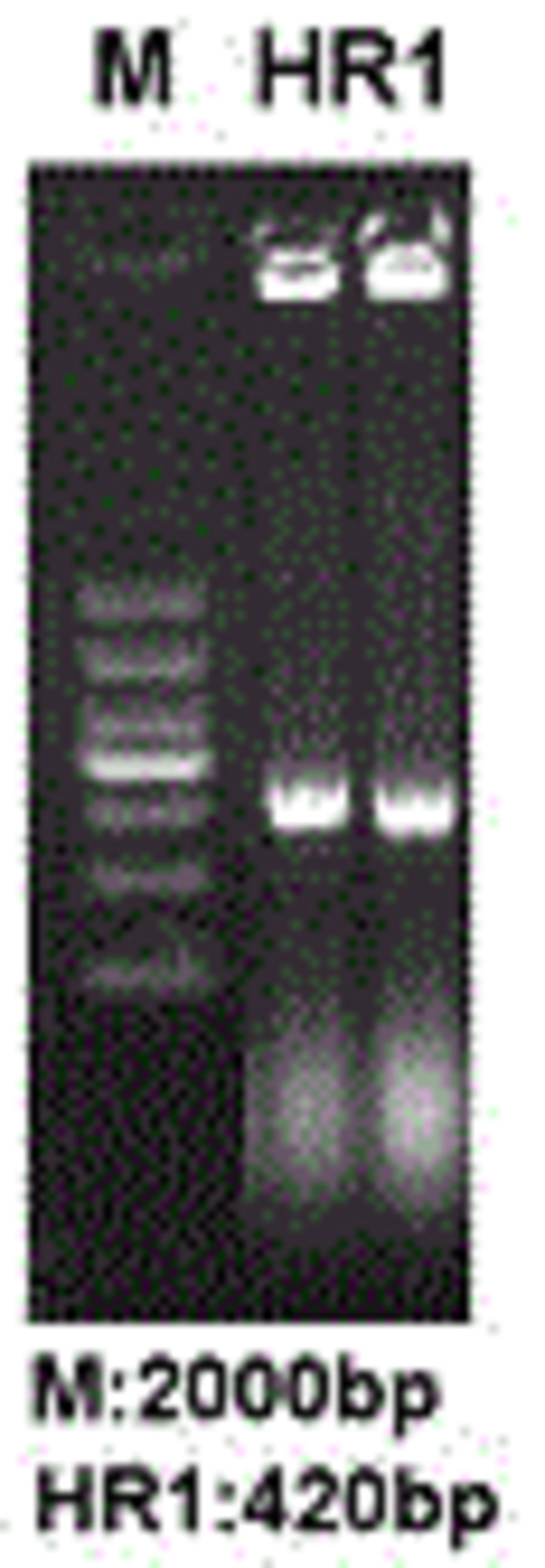 一種長鏈非編碼RNA lnc?HR1用途及克隆方法