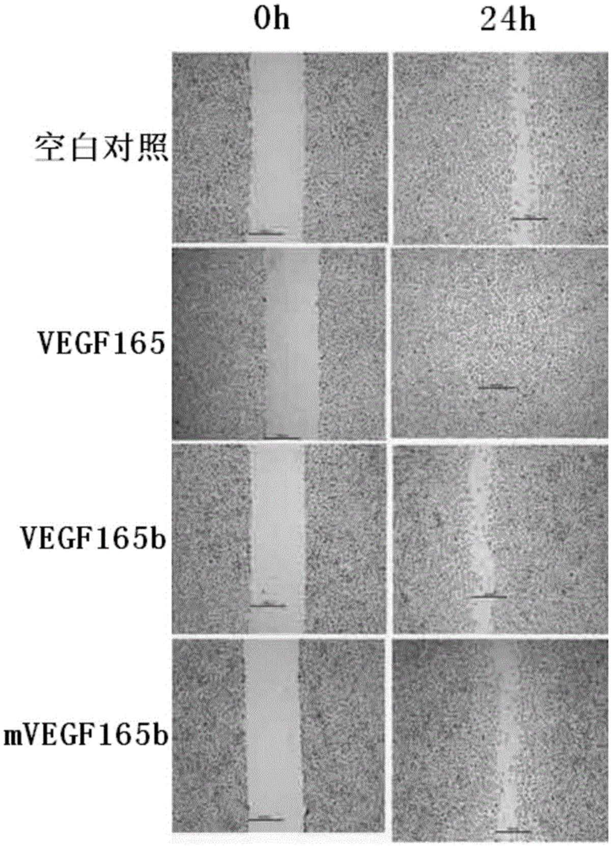 VEGF165b突變體及其制備方法和應用